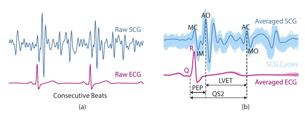 Fig. 1. SCG vs. ECG by Ghufran Shaﬁq et al. Image retrieved from [12]. License: CC-BY 4.0. Part (a) shows raw SCG signal (above) and ECG signal (below). Part (b) presents annotated SCG and ECG ensemble averages (dark lines) and superimposed SCG and ECG beats (light shades).