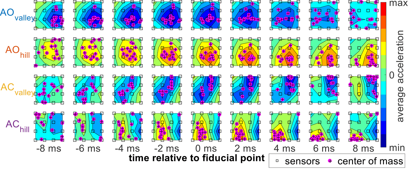 Figure 9. Mean colormaps from the 13 subjects from the SCG markers, illustrates how the center of mass propagates across the chest over time. The colormaps are normalized to the absolute maximum acceleration for each subject.
