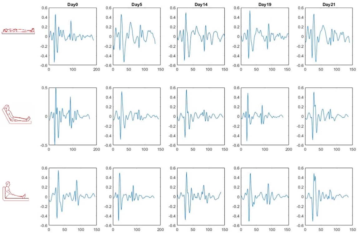 Figure 15. Longitudinal SCG beat variation in a representative subject at different postures.