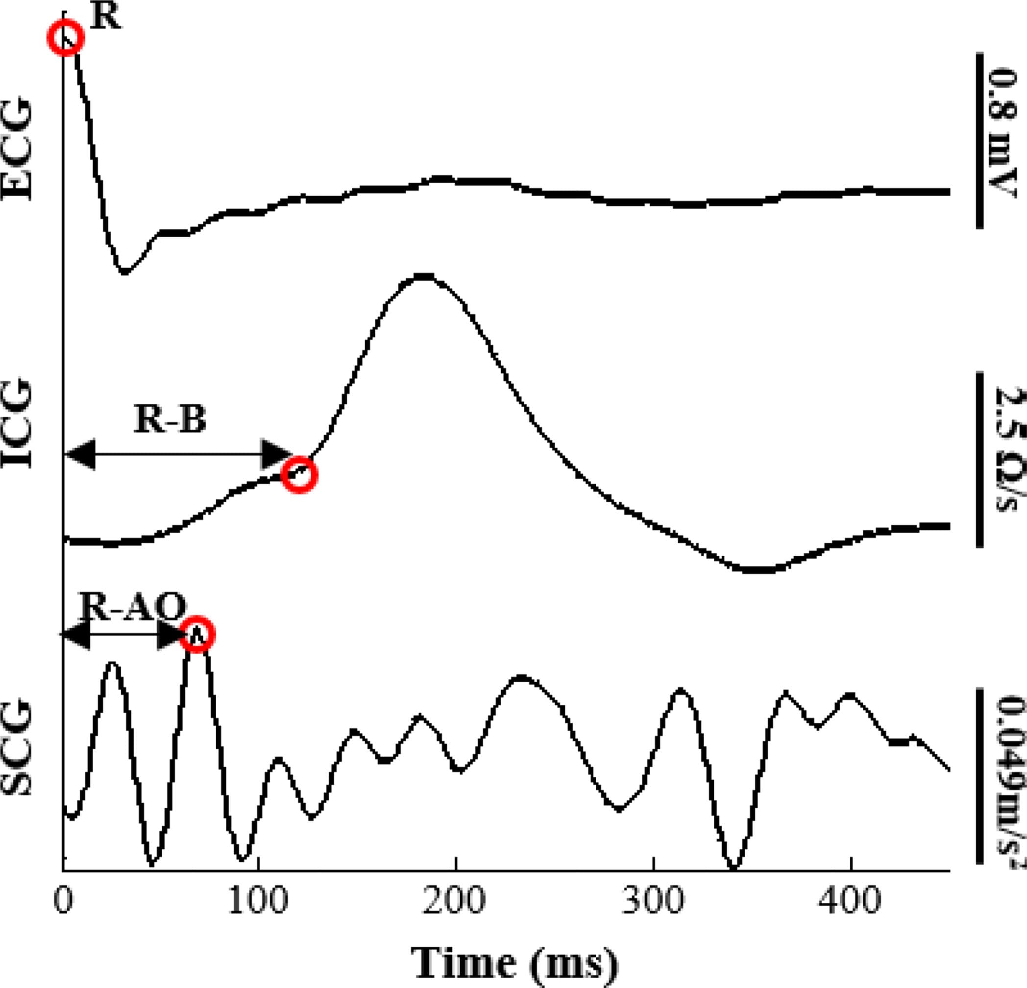 Fig. 2.  Ensemble averaged beats of ECG, ICG, and mid-sternal SCG signals with the R-peak, B- point, and AO-point annotated.