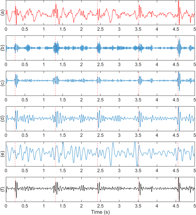 Fig. 2. MODWT decomposition showing (a) input signal, (b) first sub- band, (c) second sub-band, (d) third sub-band, (e) fourth sub-band, and (f)  reconstructed signal from first three sub-bands. ECG R-Peaks shown in red  dashed lines.