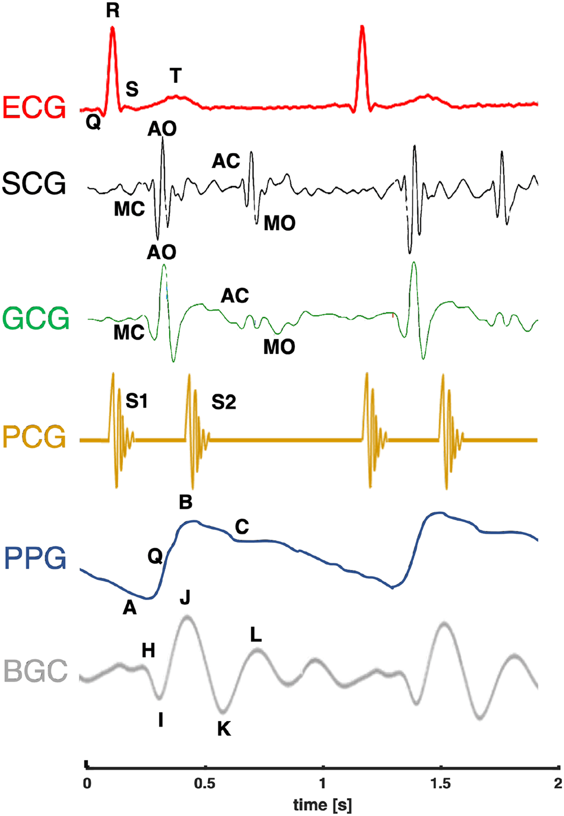 Fig. 1. Recordings of ECG, SCG (z-axis), GCG (y-axis), PCG, PPG, and BCG waveforms for a healthy subject. Relevant events include the mitral valve closure (MC) and opening (MO), the aortic valve closure (AC) and opening (AO), the S1 sound at the closure of the atrioventricular (mitral and tricuspid) valves, the S2 sound at the closure of the semilunar (aortic and pulmonary) valves, the systolic nadir (A) and end diastole (B). The H wave head-ward deﬂection begins close to the peak of the R wave and has maximum peak near the start of ejection; the I wave foot-ward deﬂection follows the H wave and occurs early in systole; the J wave largest head-ward wave follows the I wave and occurs late in systole; the K wave foot-ward wave follows the J wave and occurs before the end of systole (adapted from [23]).