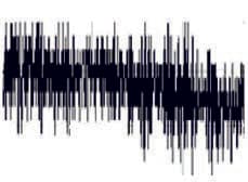 Fig. 1. Application of 8-bit accelerometer in mechanomyography