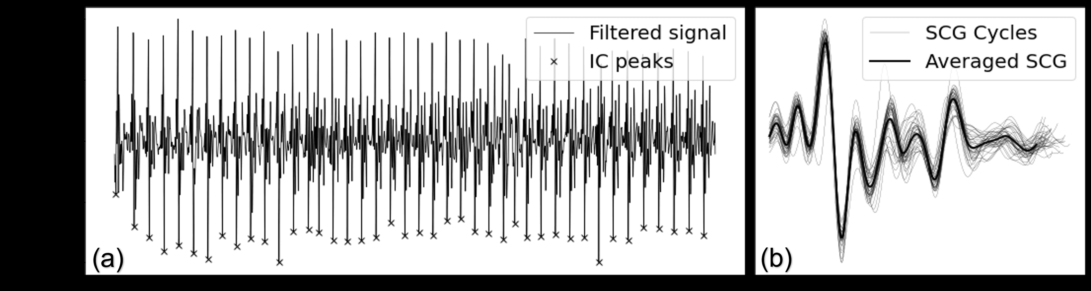 Figure 2. SCG signal measurement and segmentation. (a) Filtered signal (continuous line) and the peaks (marks) found by the pre-processing algorithm. (b) SCG cycles and their average.