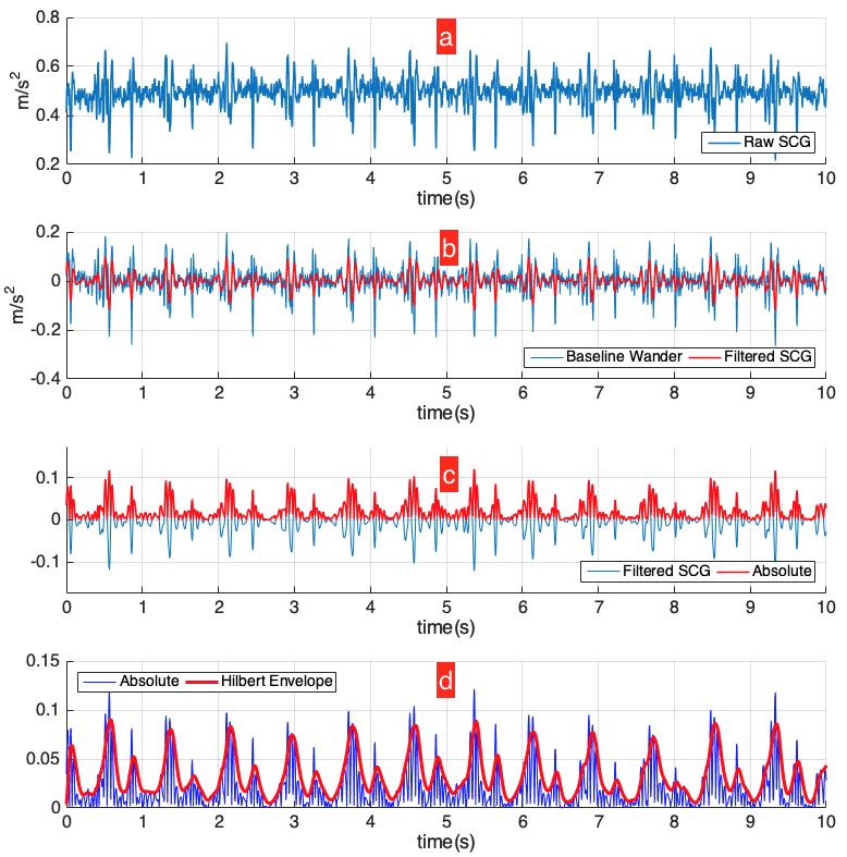 Figure 10. Signal processing in method 1 with the final  result of peak on the signal envelope identical to the AO on  the SCG signal. (a) original signal (b) filtered signal (c) and