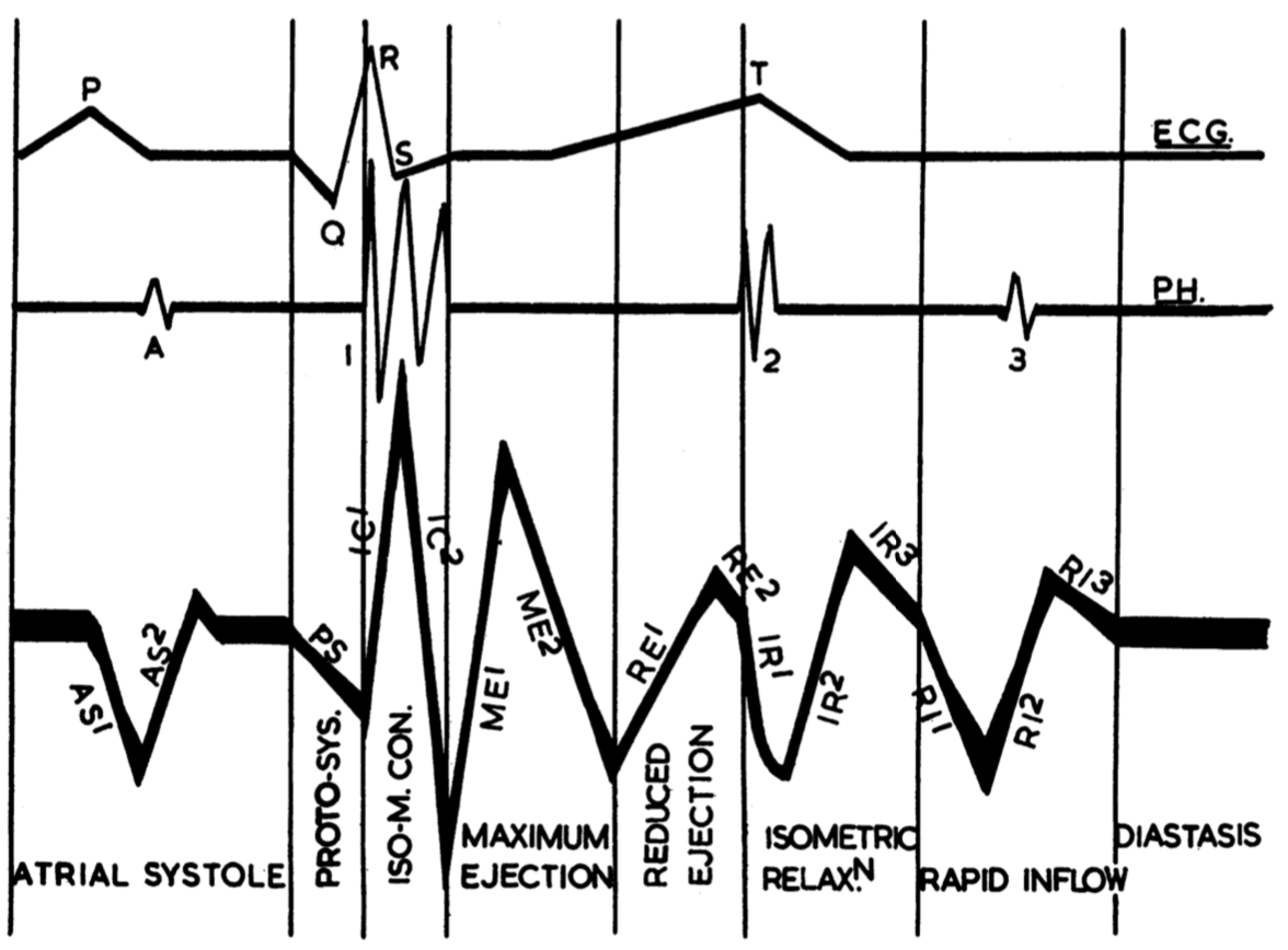 Fig. 2.4: Electrocardiogram (top), phonocardiogram (middle) and seismocardiogram (bottom) divided into eight periods: Atrial systole, protosystole, iso-volumetric contraction, maximum ejection, reduced ejection, iso-volumetric relaxation, rapid inﬂow and diastasis. The slopes are named according to the period in which the reside. ©Reprint with permission from BMJ, [19]