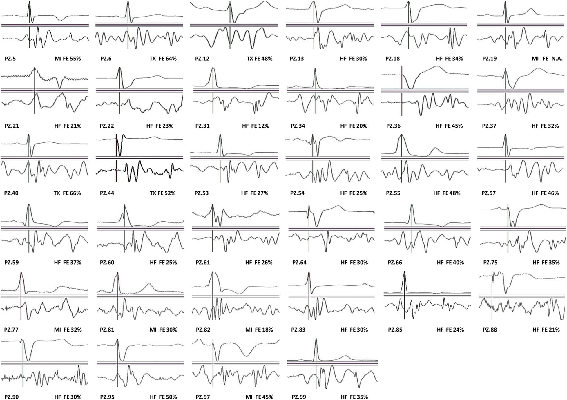 No caption found automatically.