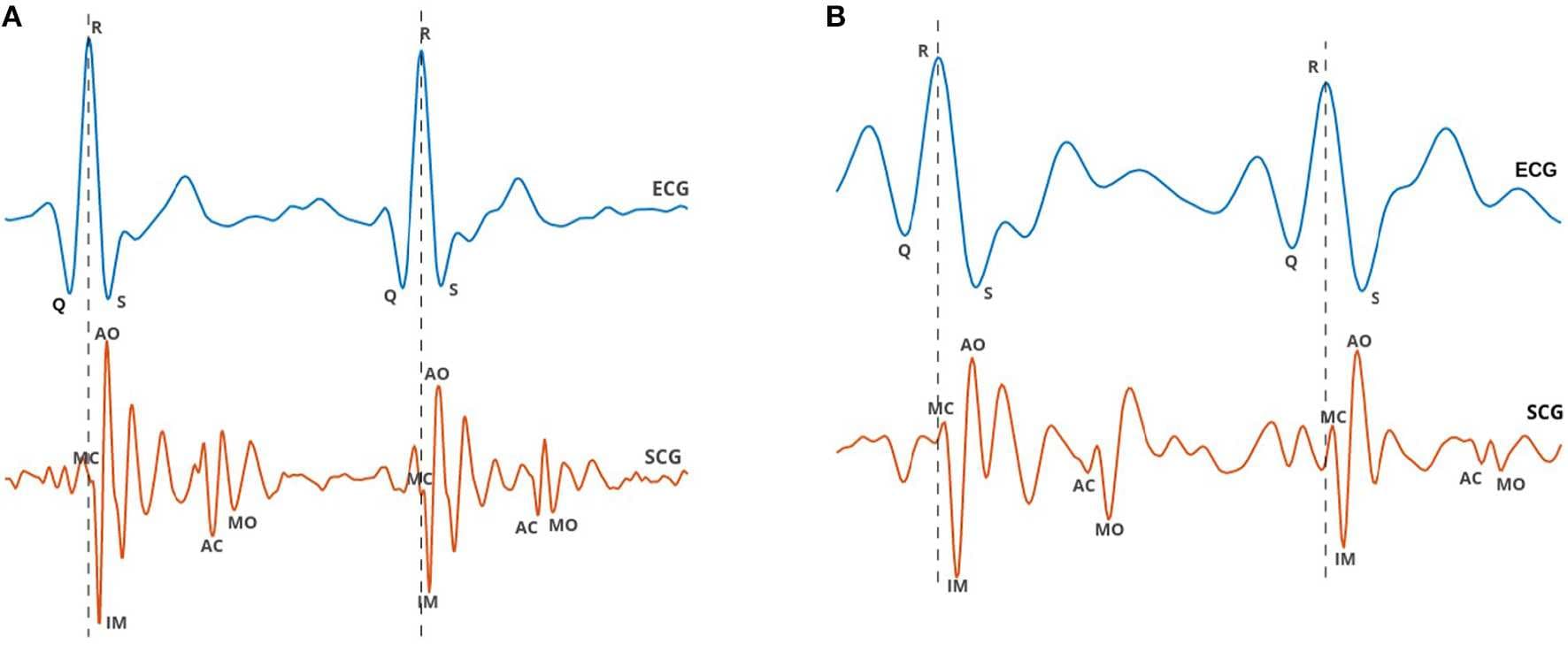 No caption found automatically.