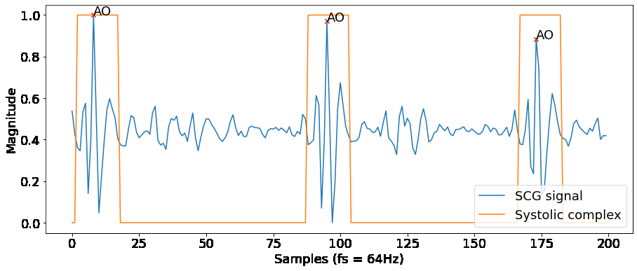 Fig. 1. AO fiducial points and systolic complexes in a clean portion of SCG signal. Note that the bounding boxes are centered in the AO points.