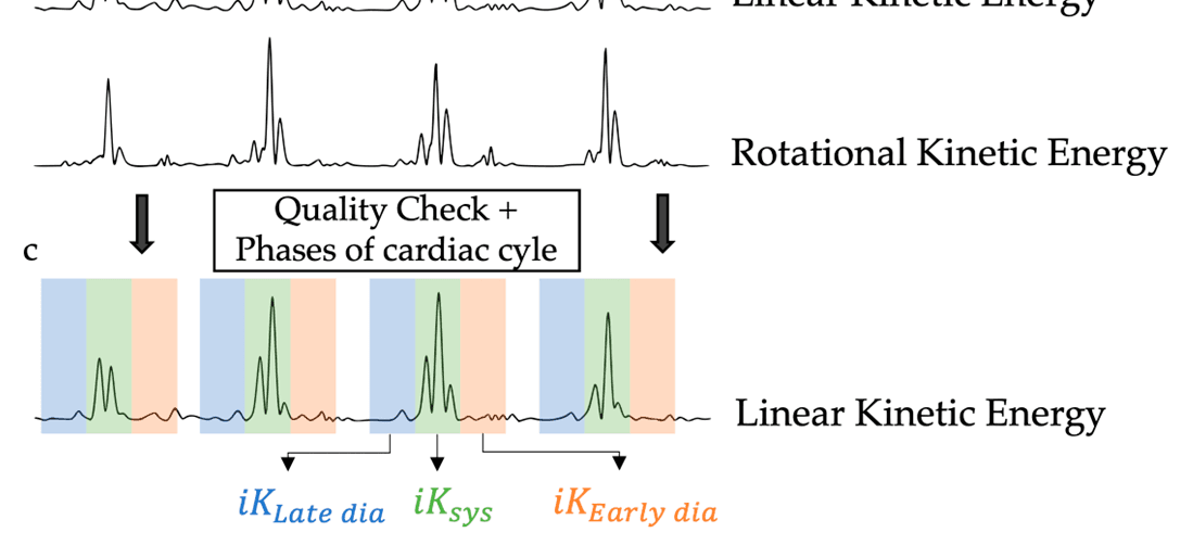 Figure 3. Schematic representation of the kinetic energy computation based on seismocardiography. (a) The 6 channels of the SCG signal, 3 linear axes, and 3 rotational axes. (b) The Kinetic Energy signal computed from the 6 channels of SCG. (c) The Kinetic Energy signal and the segmented phases of the cardiac cycle.