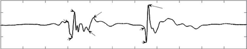 No caption found automatically.