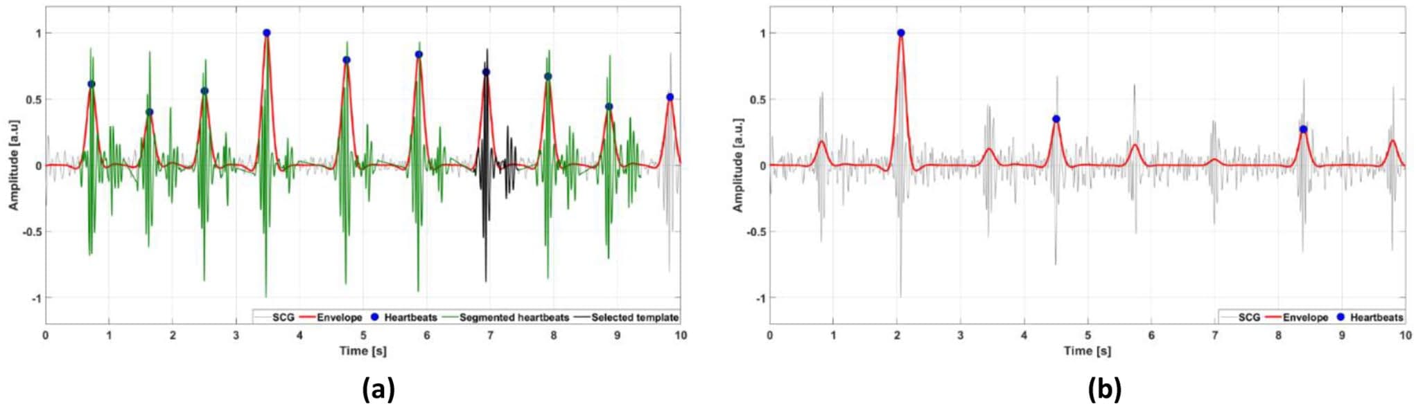 Fig. 3 Examples of 10-second segments of SCG signals classified by the automatic template selection as: (a) reliable; (b) non-reliable. The SCG signals are depicted as thin grey lines, the envelope signals as thick red lines, the locations of heartbeats (envelope peaks) are marked with full blue circles, the segmented heartbeats are depicted as thick