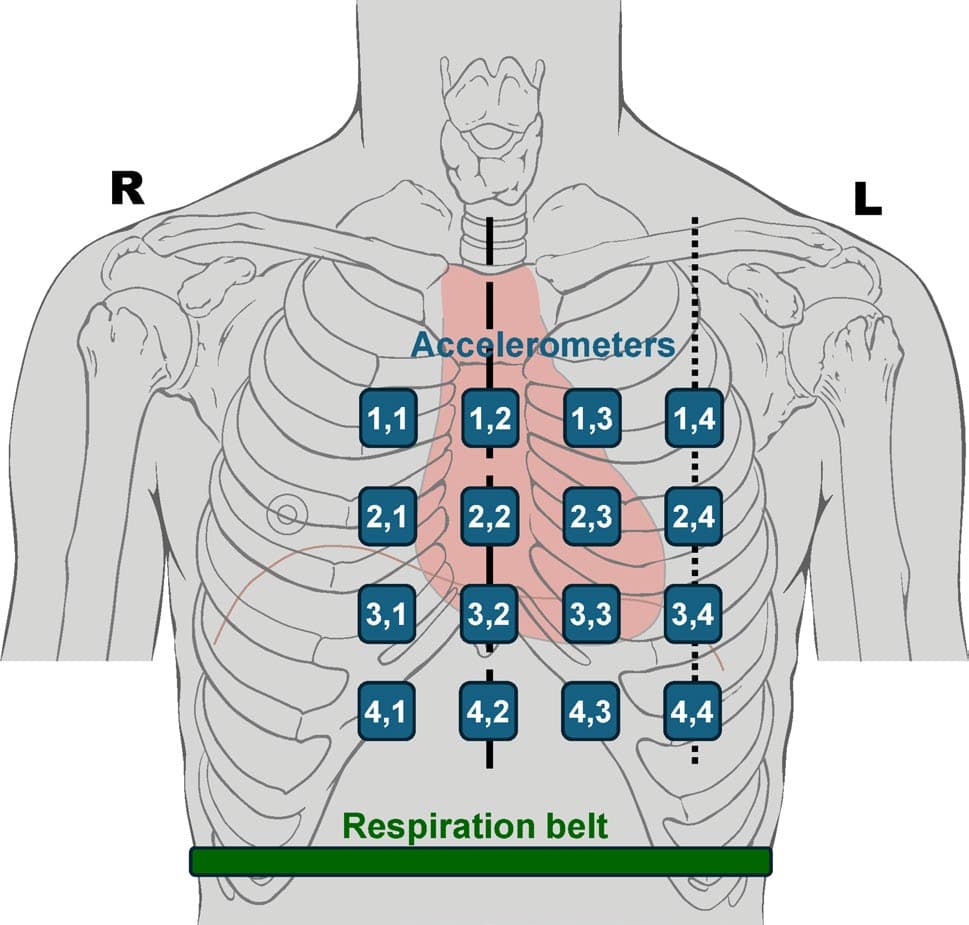 Fig. 1 Positioning of the 4-by-4 accelerometer matrix and the respira tion belt on a subject’s chest
