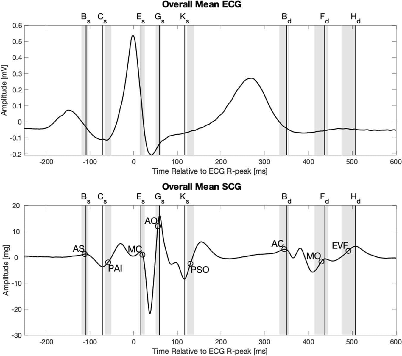 Figure 4. Overall mean electrocardiogram and seismocardiogram signal from 34 subjects. The circles indicate the mean location of the following physiologic events found in ultrasound images, from left: Atrial systole (AS), peak atrial inflow (PAI), mitral valve closure (MC), aortic valve opening (AO), peak systolic outflow (PSO), aortic valve closing (AC), mitral valve opening (MO), early ventricular filling (EVF). The grey areas indicate the 95% confidence intervals of the means for the physiologic events found in the ultrasound images.