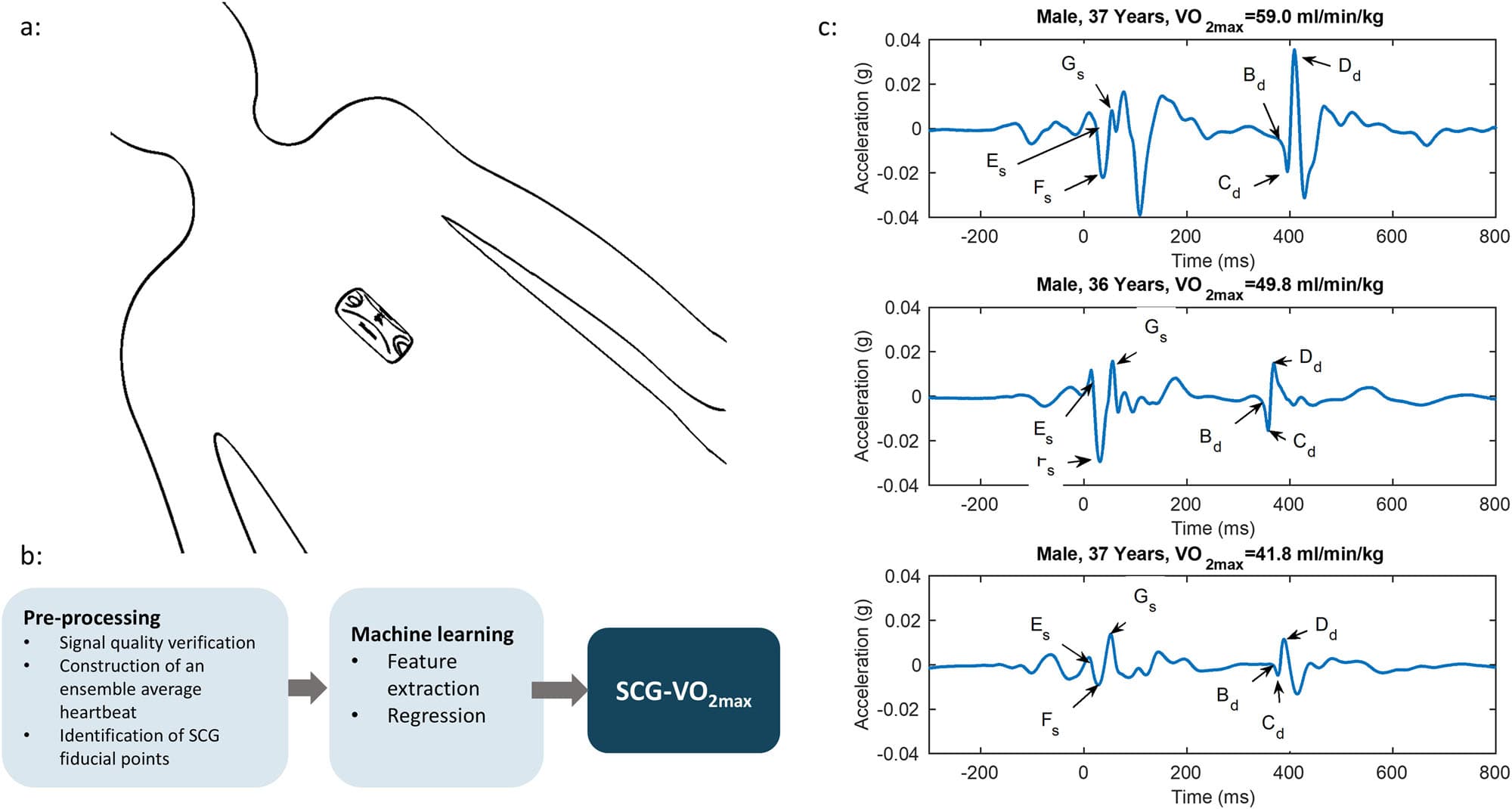 Fig. 3 | Sensor and signal overview. a The SCG sensor is mounted at the lower sternum. b Overview of the algorithm steps. c Ensemble average SCG waveforms from three subjects with different levels of fitness. The Es fiducial point marks the