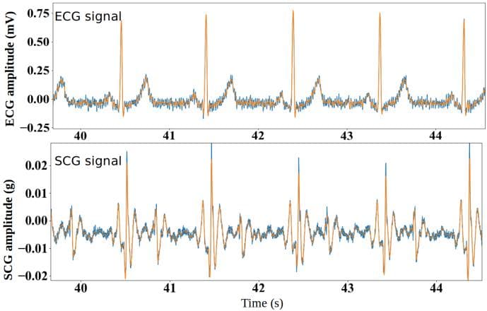 Figure 5. An example of simultaneously recorded ECG and SCG