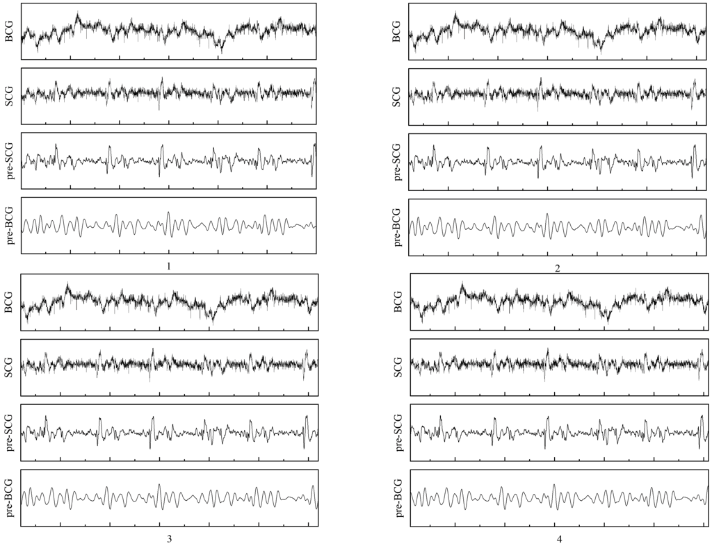Figure 5. placement test results.