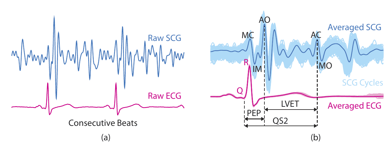 Figure 3: Heart beat detection algorithm flowchart.