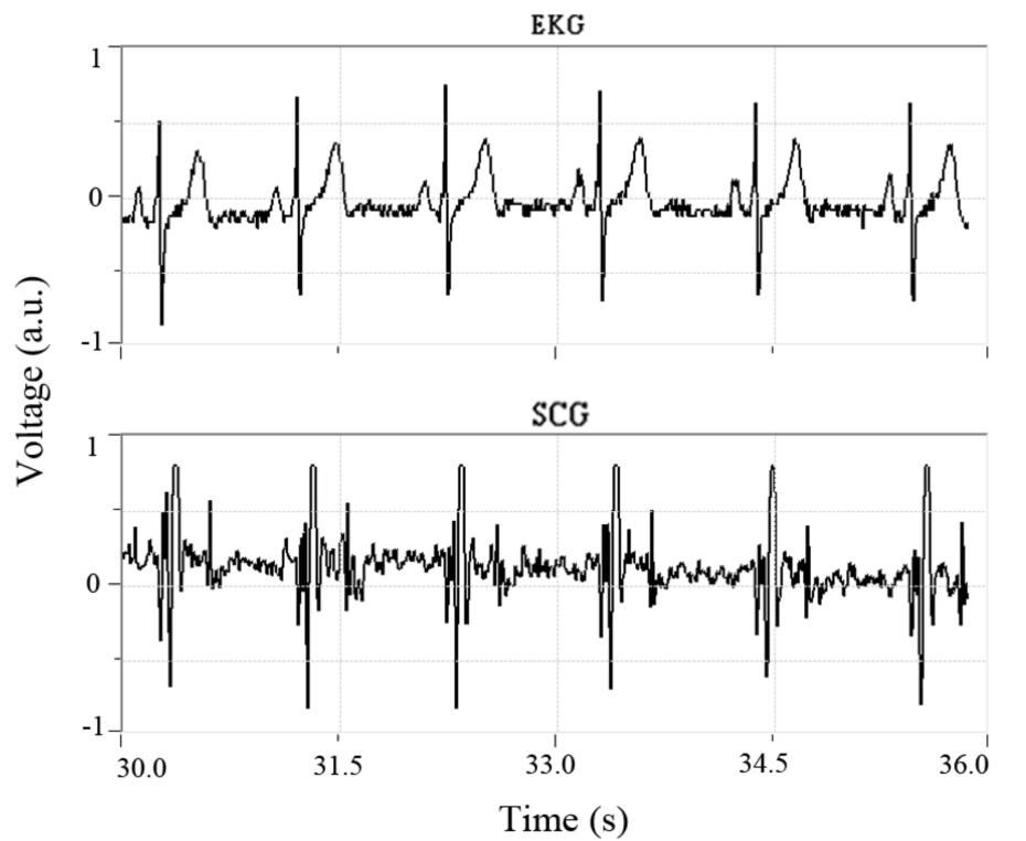 Fig. 5. Software interface for our custom device displaying the simultaneously acquired EKG data (top) and SCG data (bottom).