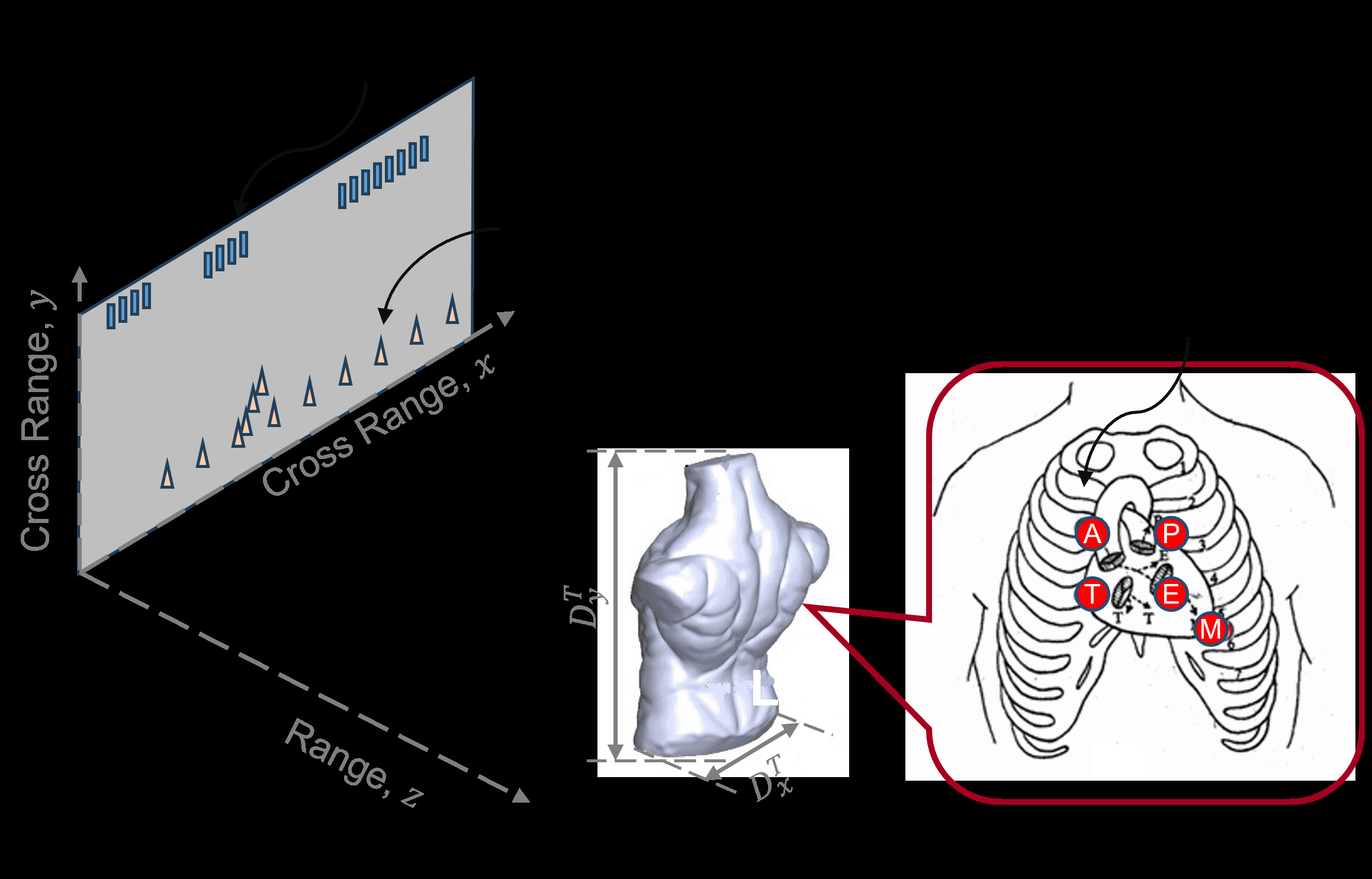 Fig. 1: Research scenario of multi-point vital sign monitoring with mmWave MIMO radar. The MIMO radar system is placed in front of the human chest wall and used to estimate the motion of the five scattering points of interest, i.e., point A, P, T, E, and M.