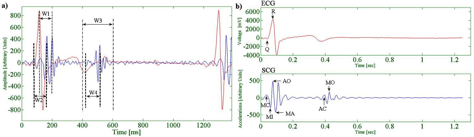 Figure 2. (a) Windowing for Event Detection. (b) Detected Cardiac Events within SCG and ECG.