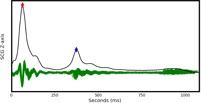 Figure 4: Example of AO (Red Diamond) and AC (Blue Diamond) extraction from CCAvg waveform. Green signal represents the grouped cardiac cycles used to create CCAvg.