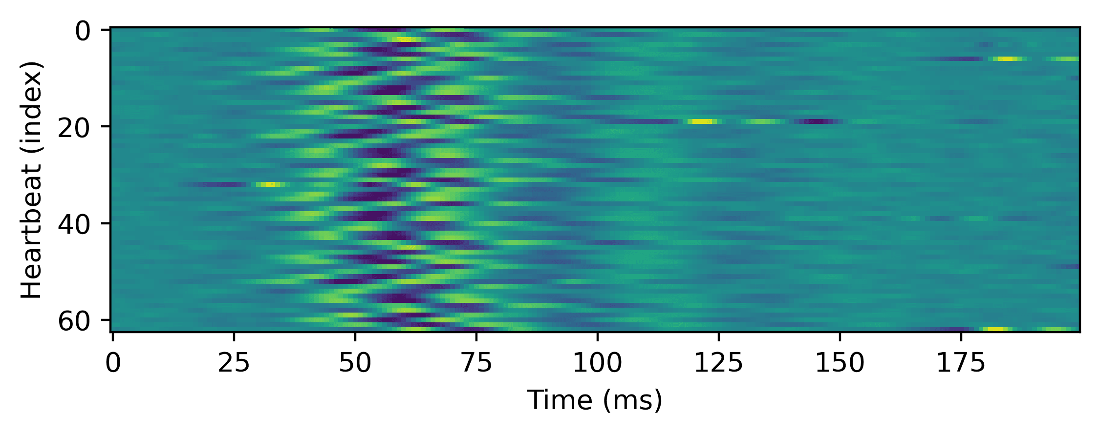 Figure 2. Pre-processing illustration: Example S2 ma- trix, prior to zero padding the bottom rows.