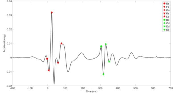 Figure 1: Demonstration of SCG with fiducial points used in the study. The red marks are the systolic and the blue marks are the diastolic variables. IVCT = Isovolumetric cardiac ejection time, LVET = Left ventricular ejection time, IVRT = Isovolumetric relaxation time, g = gravita- tional constant.