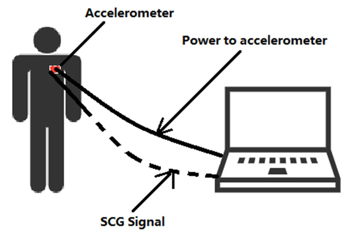 Figure 2. A schematic of SCG measurement device.