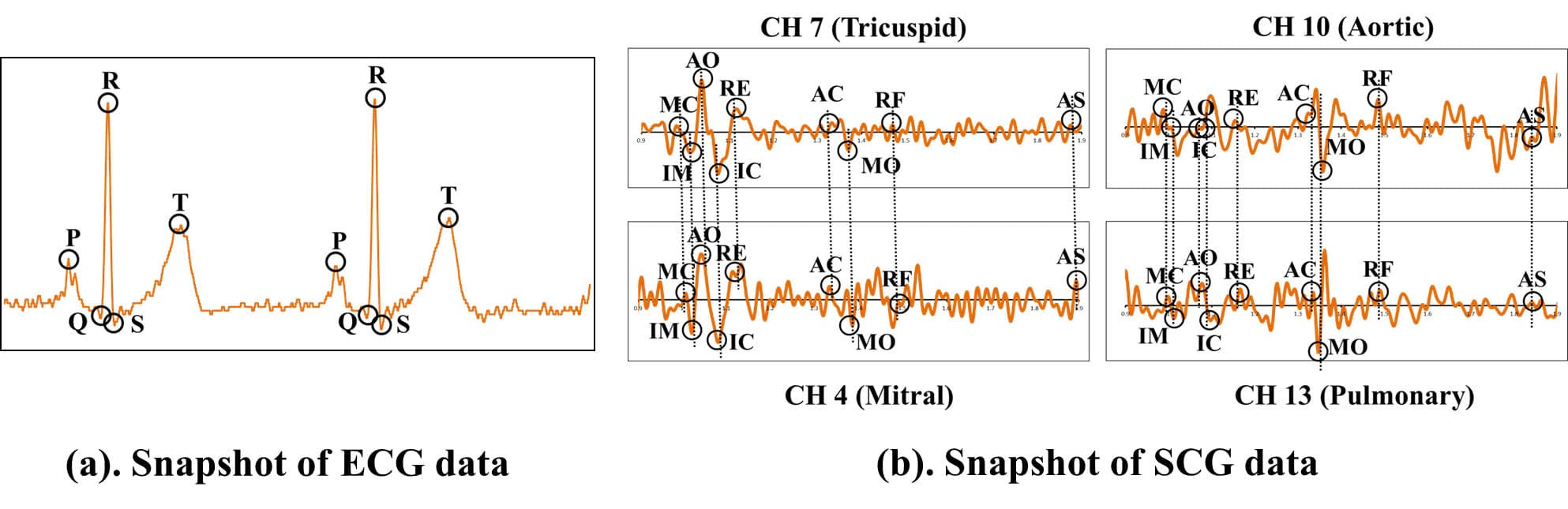 Figure 14. Visualization of ECG and SCG data acquired from PowerLab.