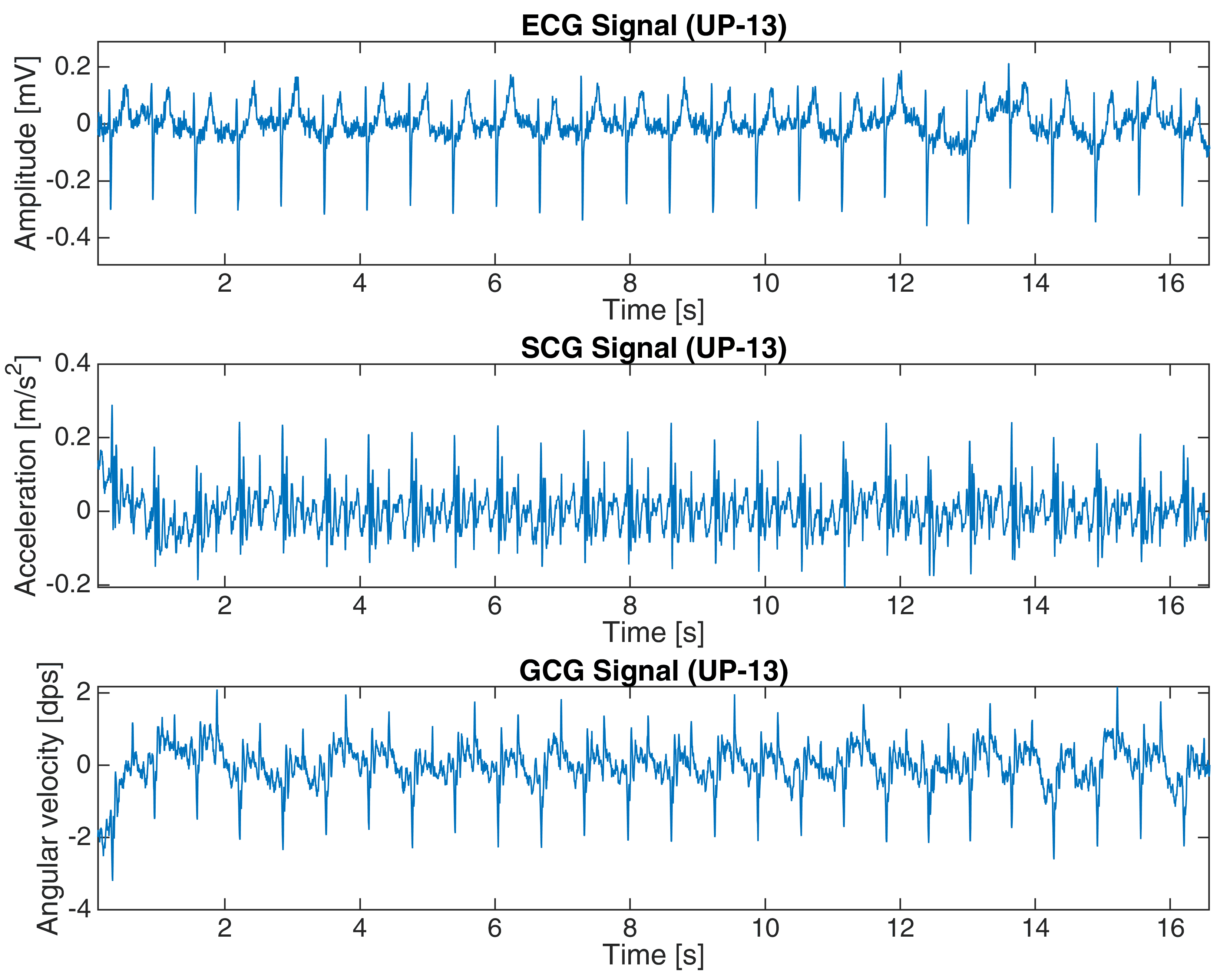 Figure 3. ECG, SCG and GCG signals from subject UP-13 in the second dataset (16-s fragment).