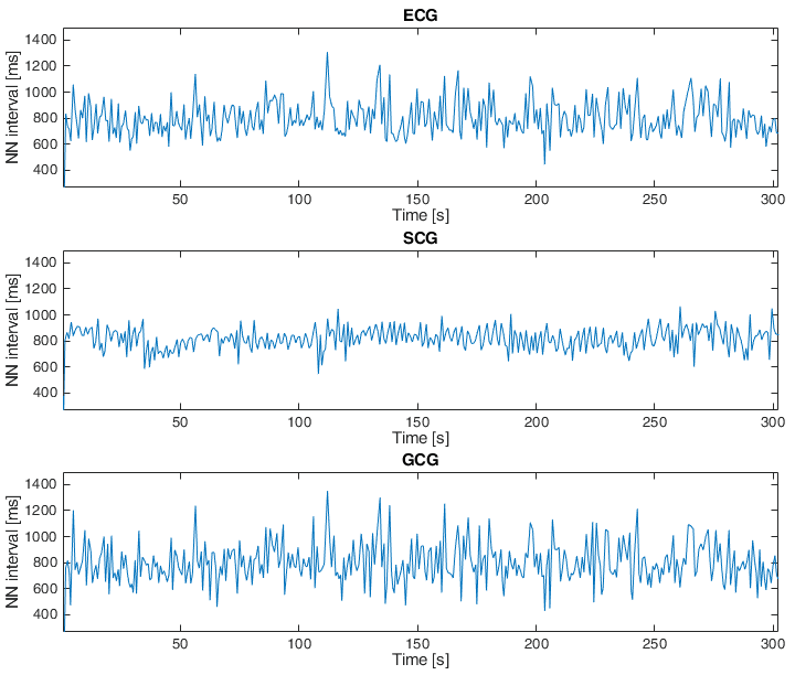 Figure 4. Tachogram derived from ECG, SCG and GCG signals taken from subject 9 in the first dataset (15-second fragment).