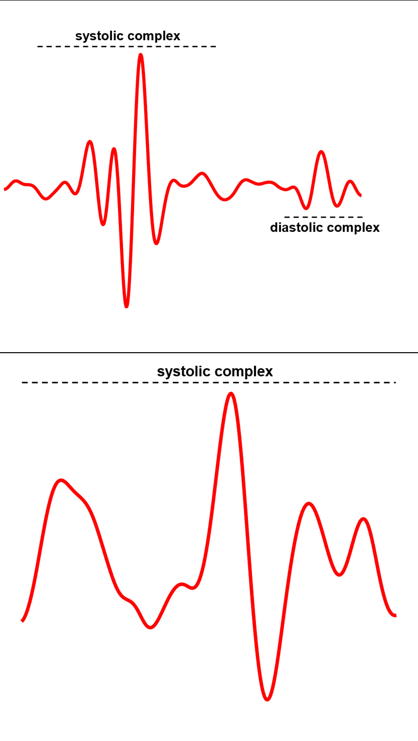 Table 2. Template selection criteria. The templates depicted in the table correspond to those high- lighted in red in Figure 2.