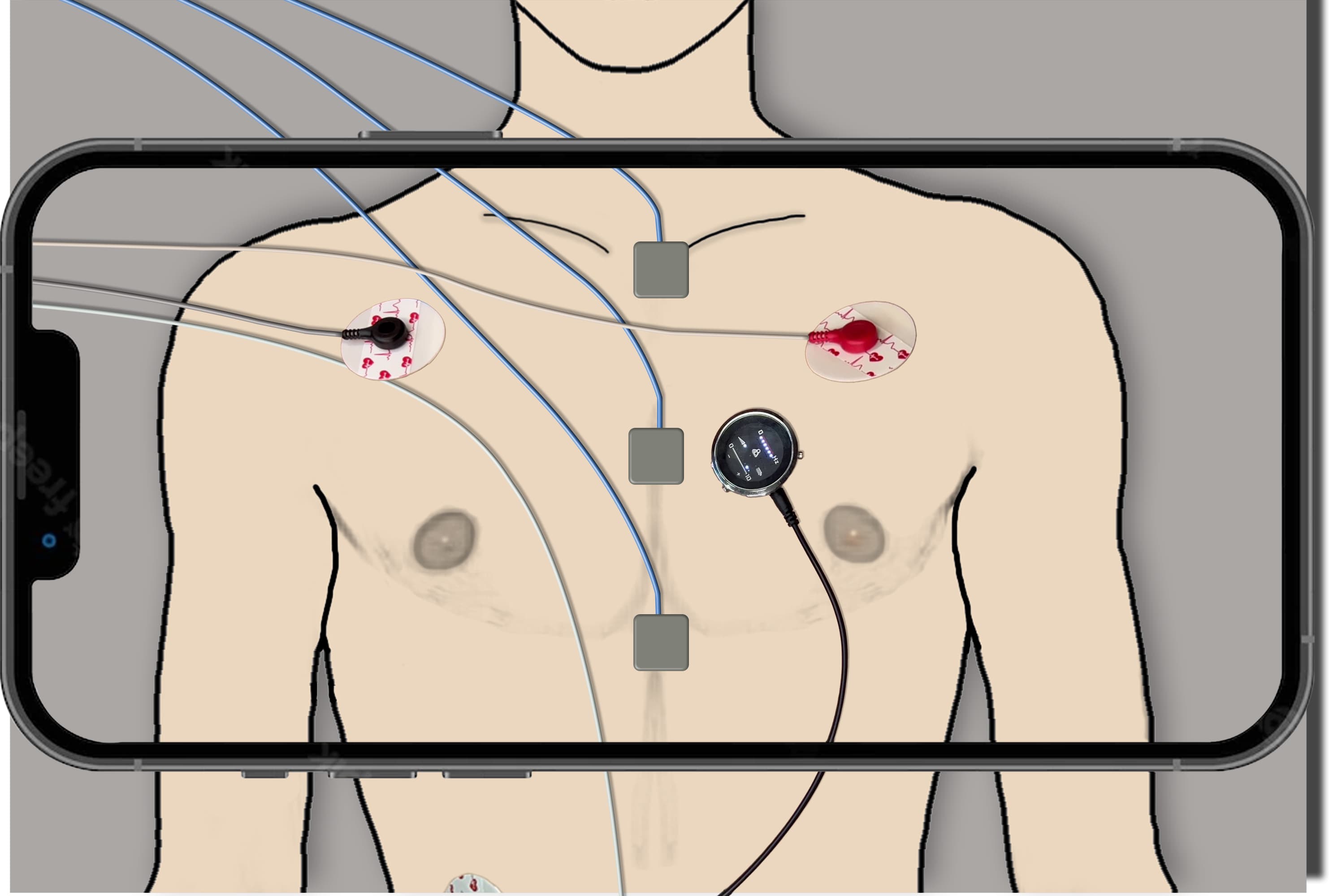 Fig. 1. Data acquisition setup. The sensors include (a) a single-lead ECG, (b) three tri-axial accelerometers, and (c) an electronic stethoscope.