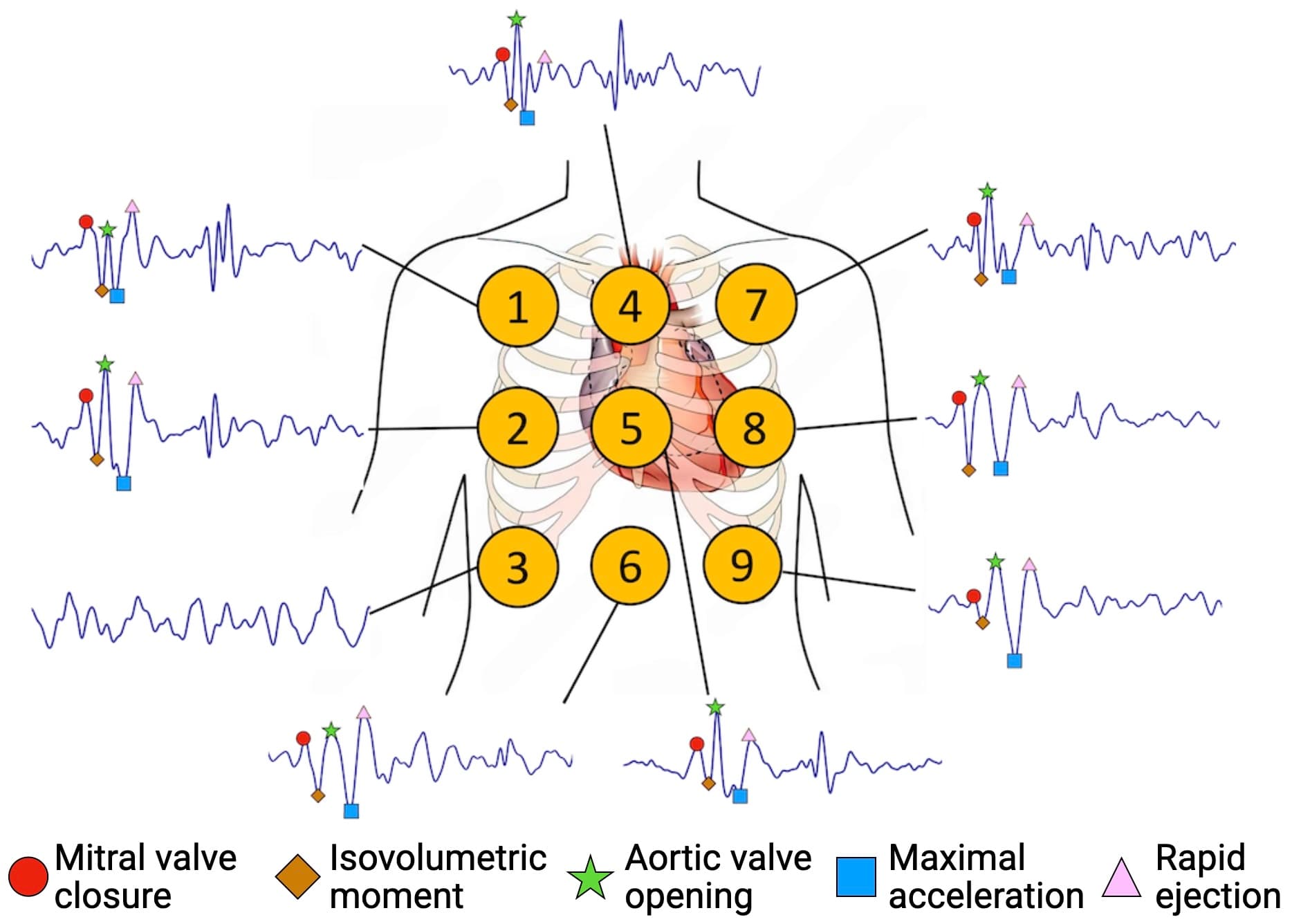 Figure 3: Challenge of conventional IMU-based micro-cardiac measurements. Differences in sensor placement lead to vari- ations in waveforms, making comparisons across repeated measurements challenging. Precise and consistent placement is difficult to ensure when measurements are performed by lay users outside clinical settings. Each waveform cor- responds to a cycle of 800 ms, and amplitudes are normalized to their own maximum.